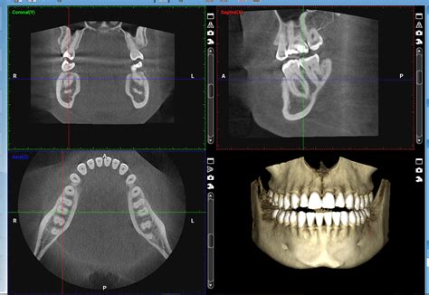 Cone Beam Computed Tomography .